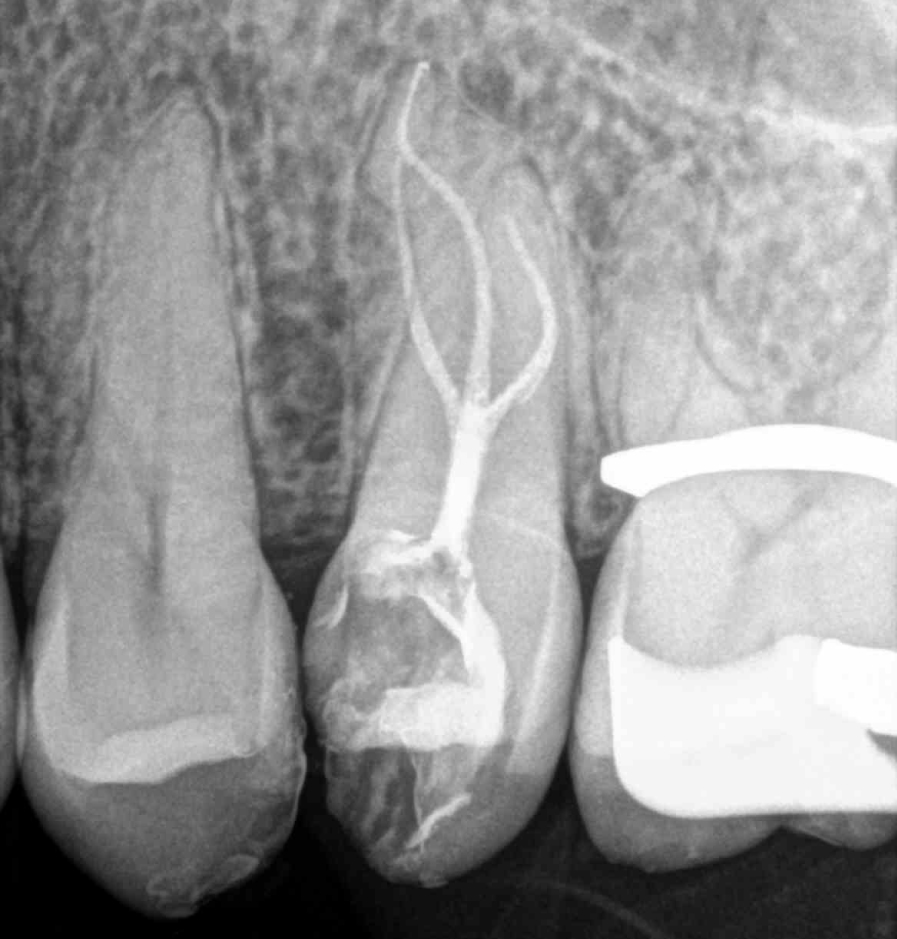 2.5 Anatomía compleja