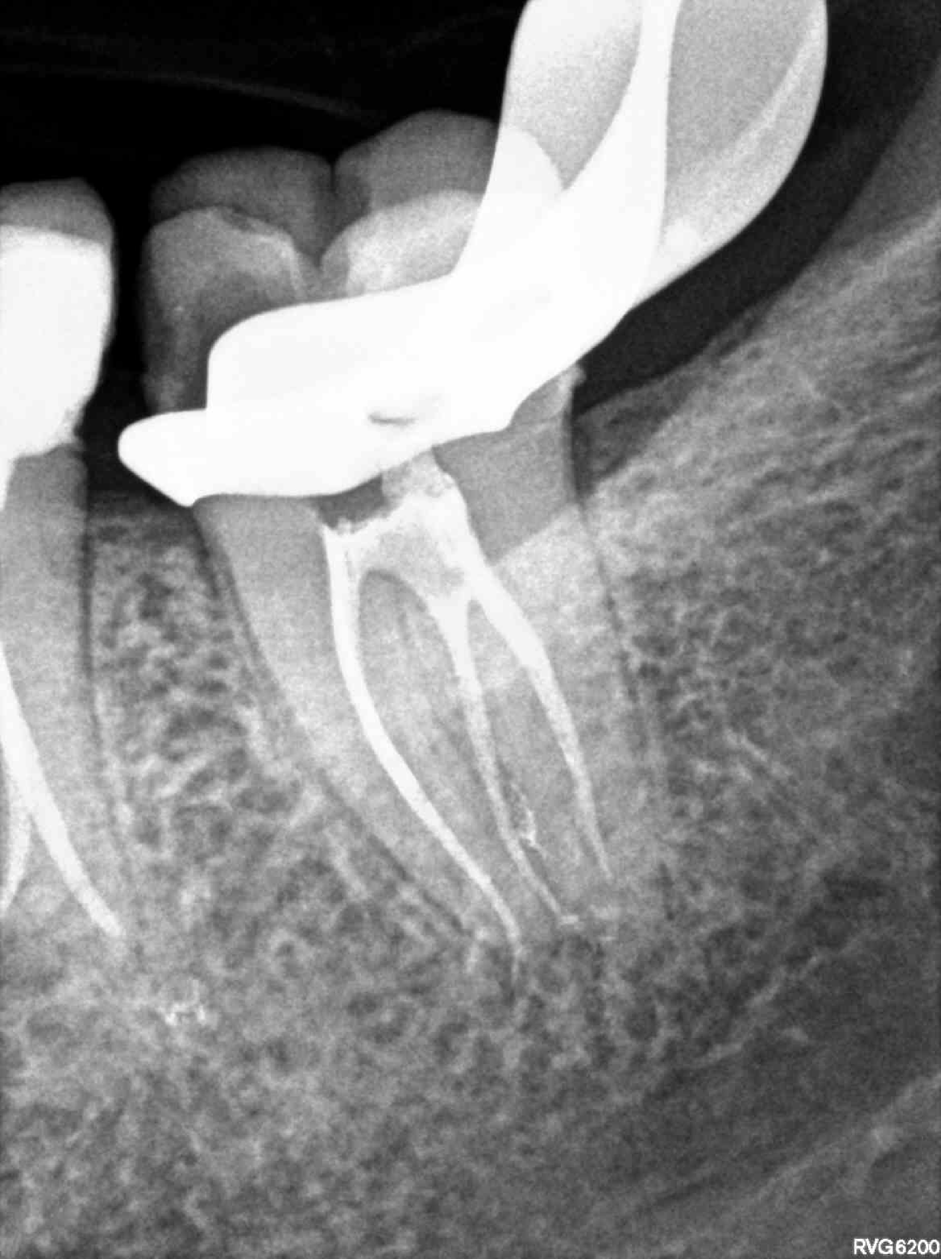 3.7 Interesante anatomia